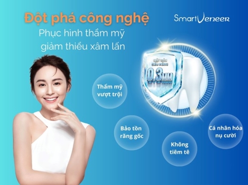 Dán sứ Smart Veneer – Dán sứ một lần đẹp trọn đời (3)
